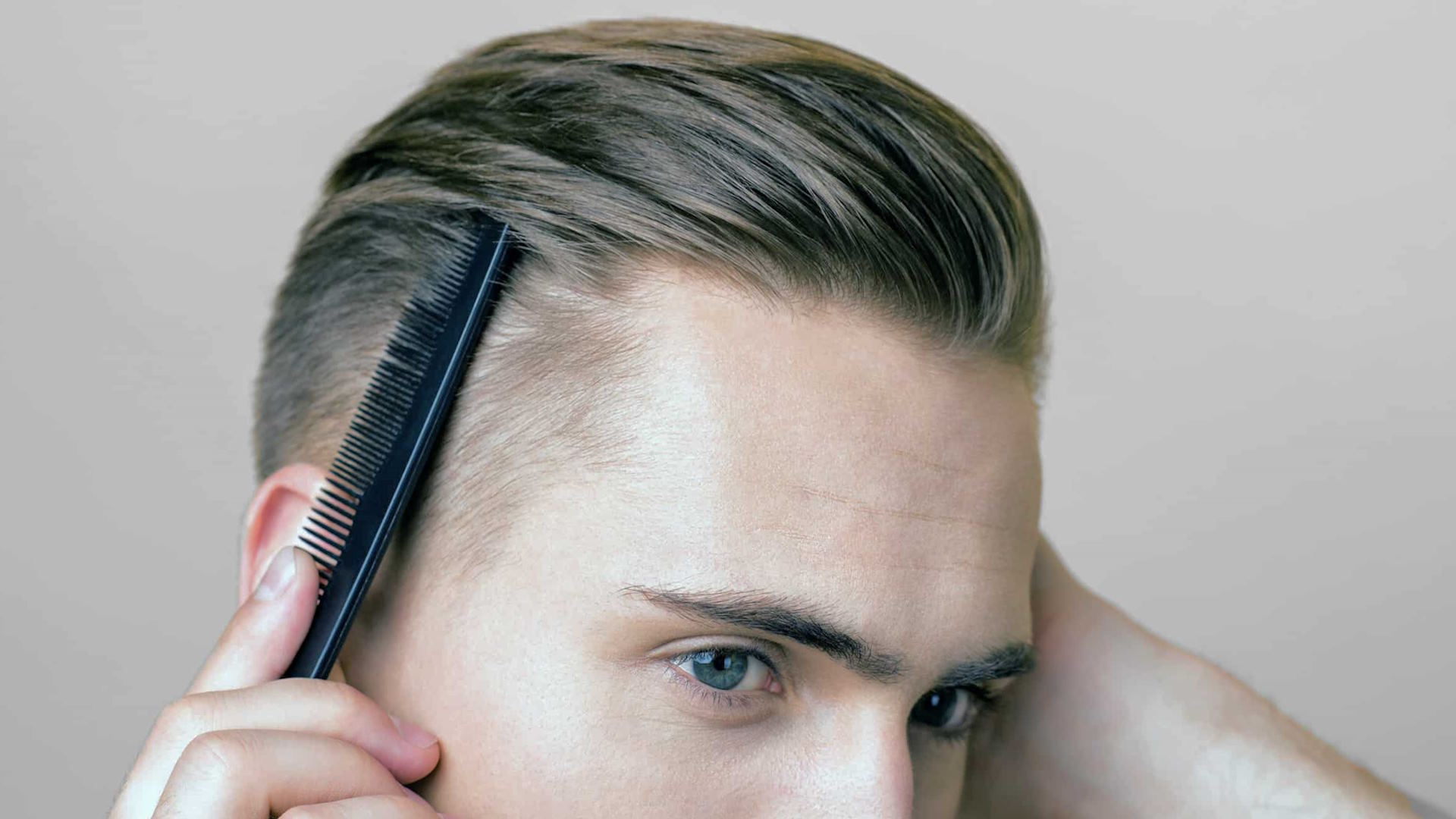 Hairstyles for Balding Men