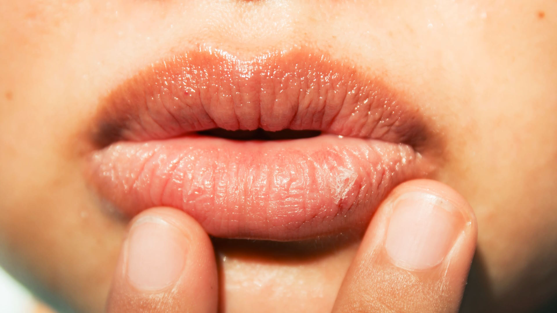 How to Treat Chapped Lips with Natural Ingredients